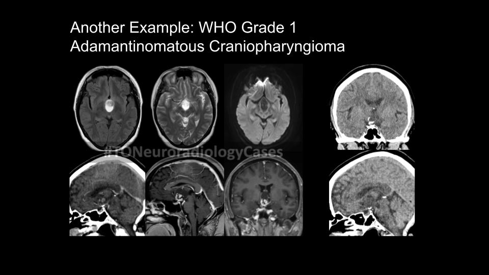 11M visual disturbance ans2