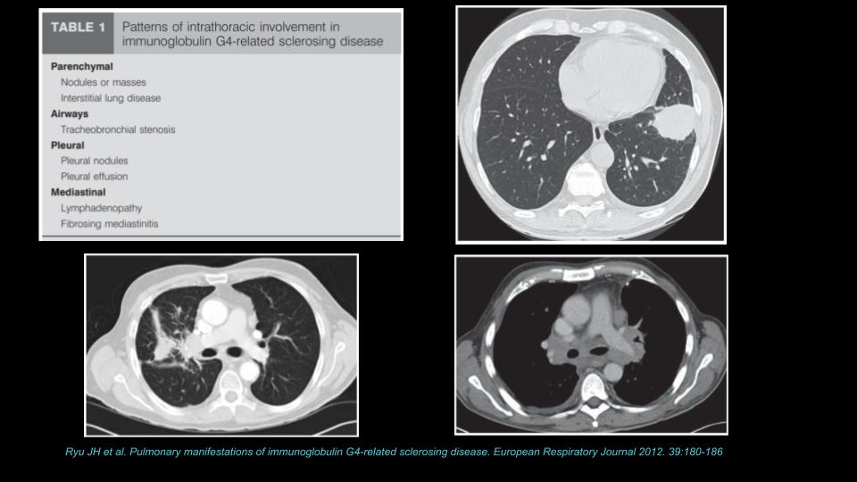 65M-skull-lump-ans-2