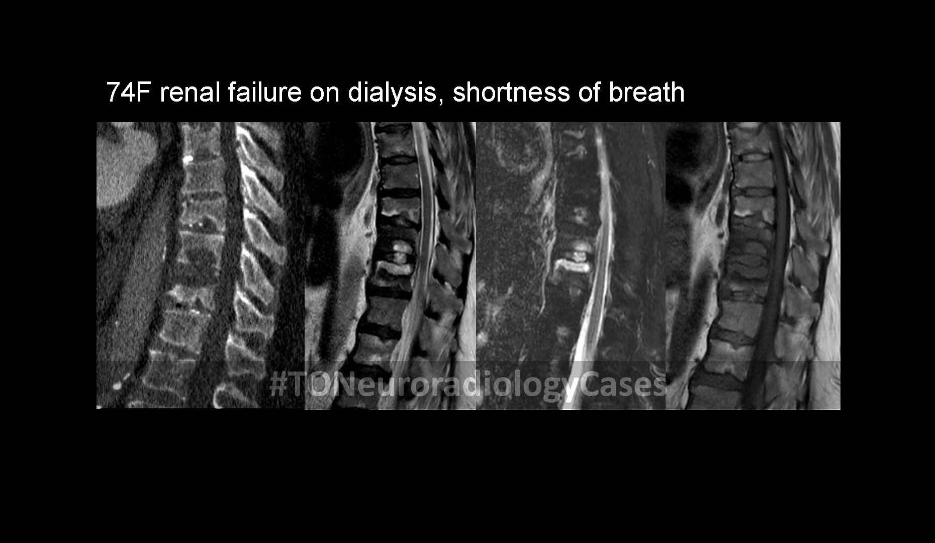 Neuroradiology Case of the Week: Week 49