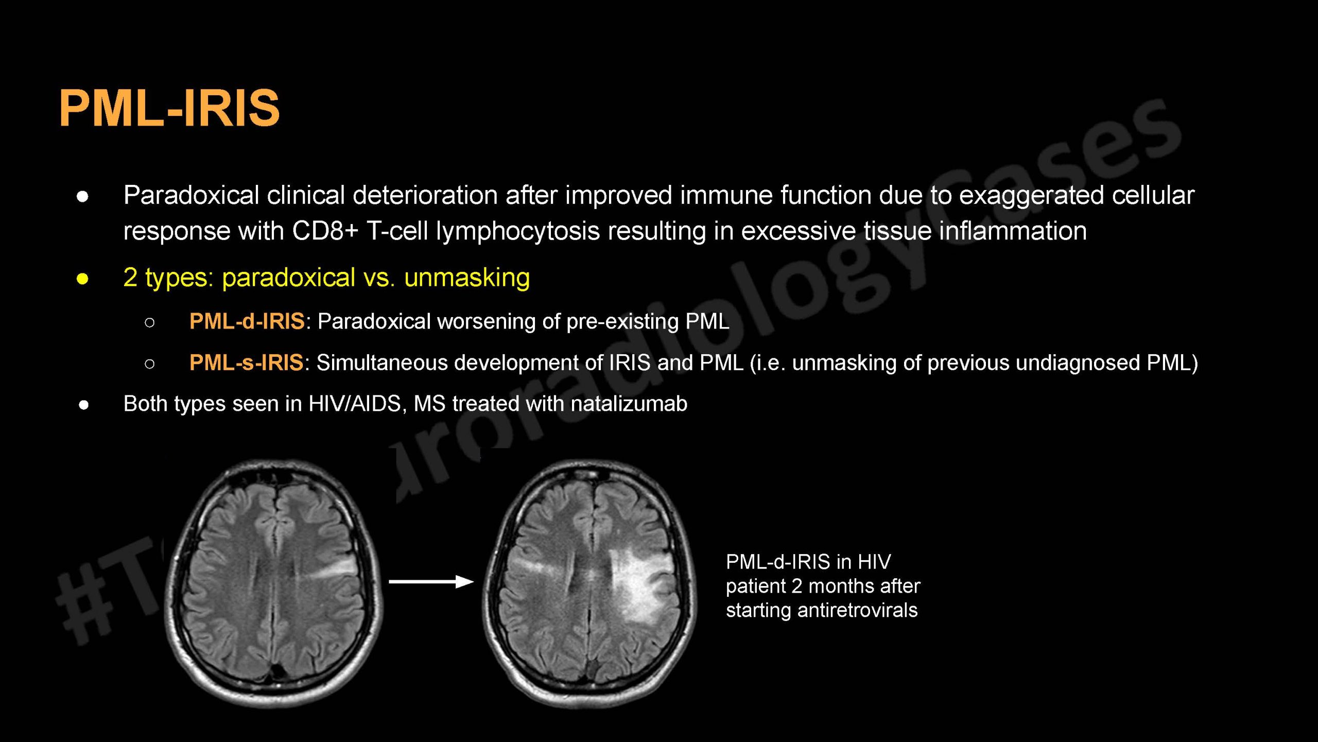 Neuroradiology Case of the Week: Week 63 3 Neuroradiology Case of the Week: Week 63 - Toronto Radiology